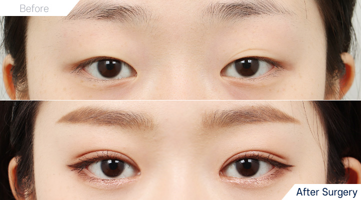 상품128前后照片